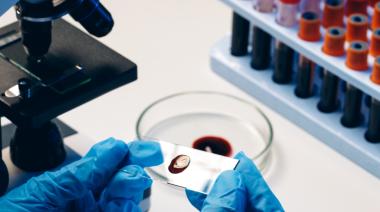 Por el impacto de la inflación, los laboratorios de análisis clínicos amenazan con no atender a pacientes
