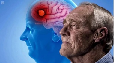 Dr. Carlos Mangone: "Se calcula que Argentina hay alrededor de 400 mil pacientes sufriendo Alzheimer"