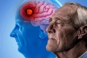 Dr. Carlos Mangone: "Se calcula que Argentina hay alrededor de 400 mil pacientes sufriendo Alzheimer"